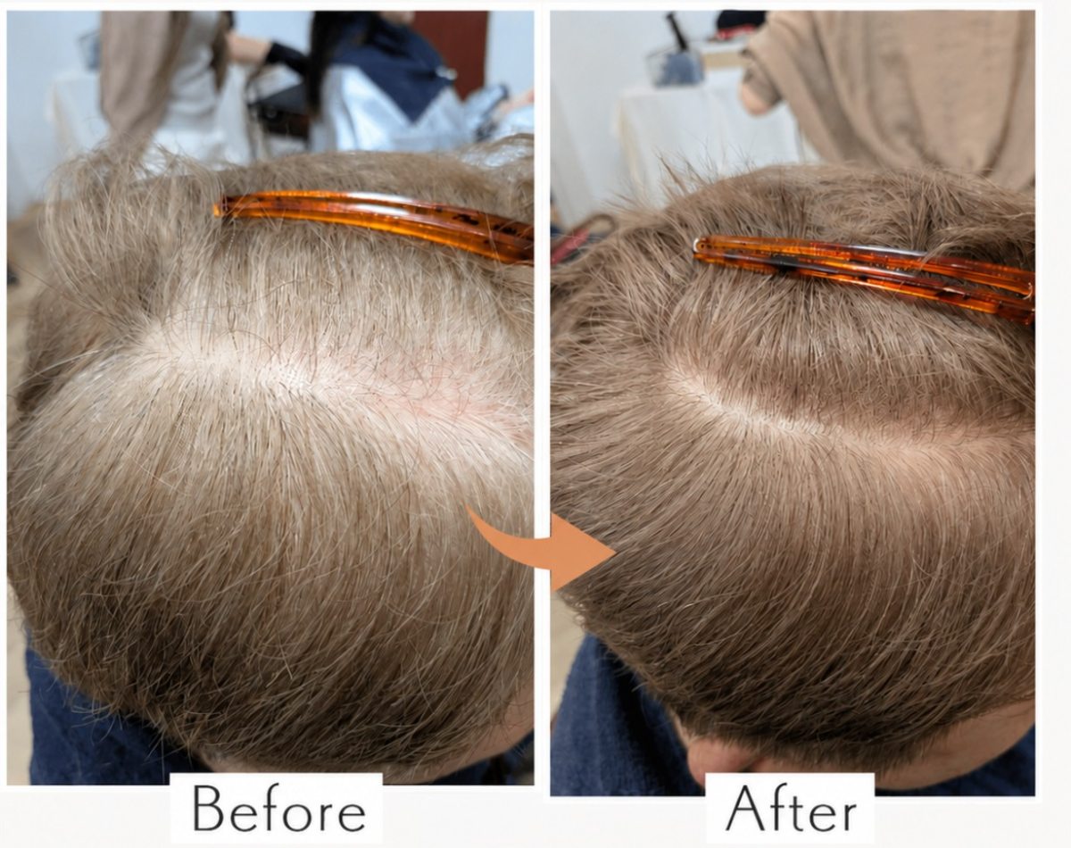 白髪率 約80%、白髪を明るく活かしたカラーのビフォーアフター